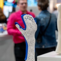 Modernly designed hand orthosis with 3D-printed honeycomb pattern and blue accents on display at OTWorld, with trade fair visitors conversing in the background Modernly designed hand orthosis with 3D-printed honeycomb pattern and blue accents on display at OTWorld, with trade fair visitors conversing in the background