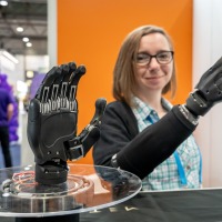 An exhibitor proudly showcases a high-tech prosthetic hand at OTWorld. An exhibitor proudly showcases a high-tech prosthetic hand at OTWorld.